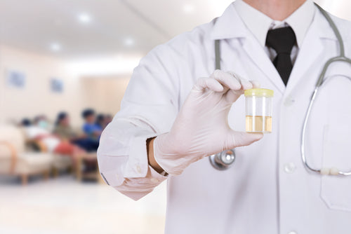 Doctor in white coat holding a urine sample container in a clinical setting with blurred patients in the background